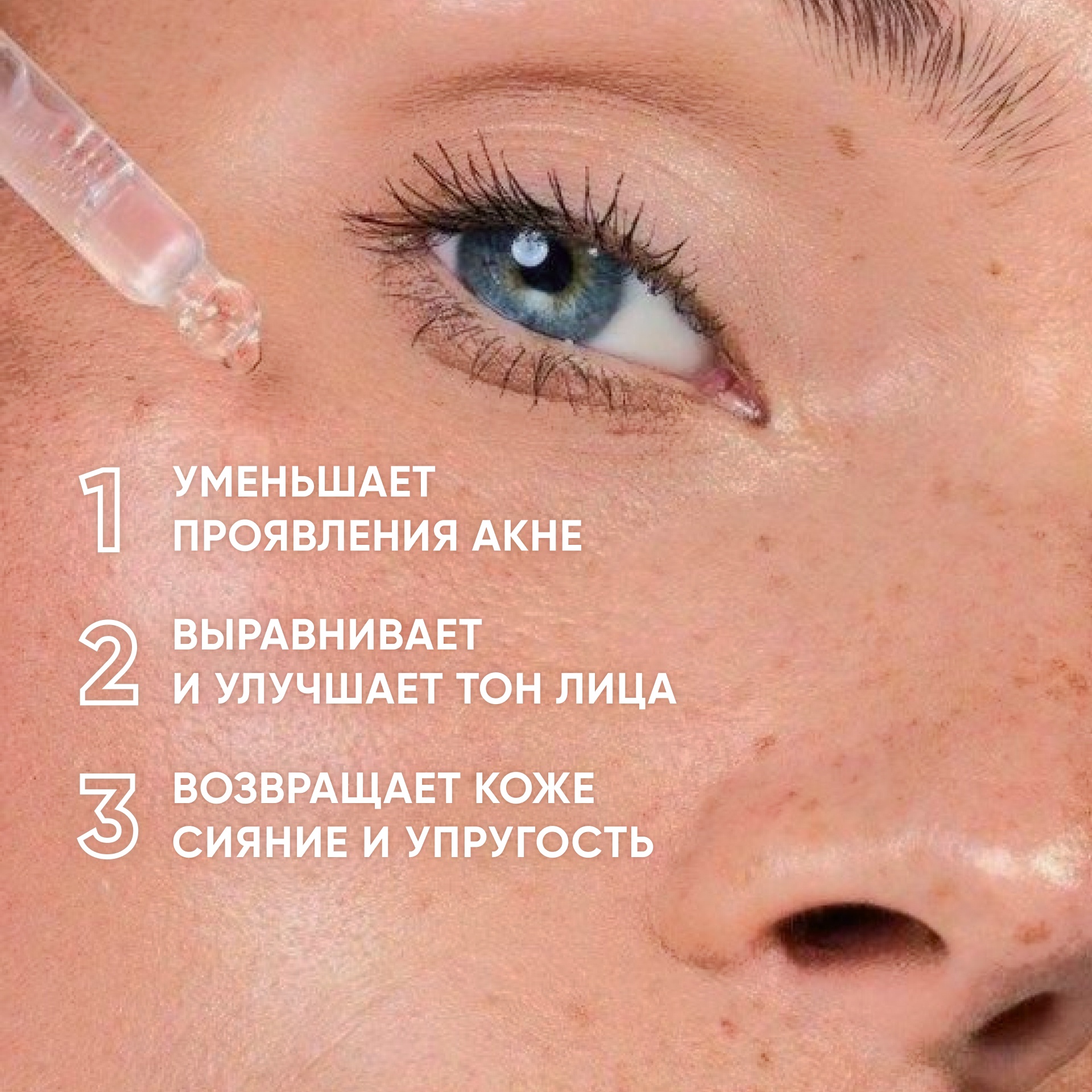 Пилинг-система для проблемной кожи 8% Anti-acne Smart Peel System купить в VISAGEHALL