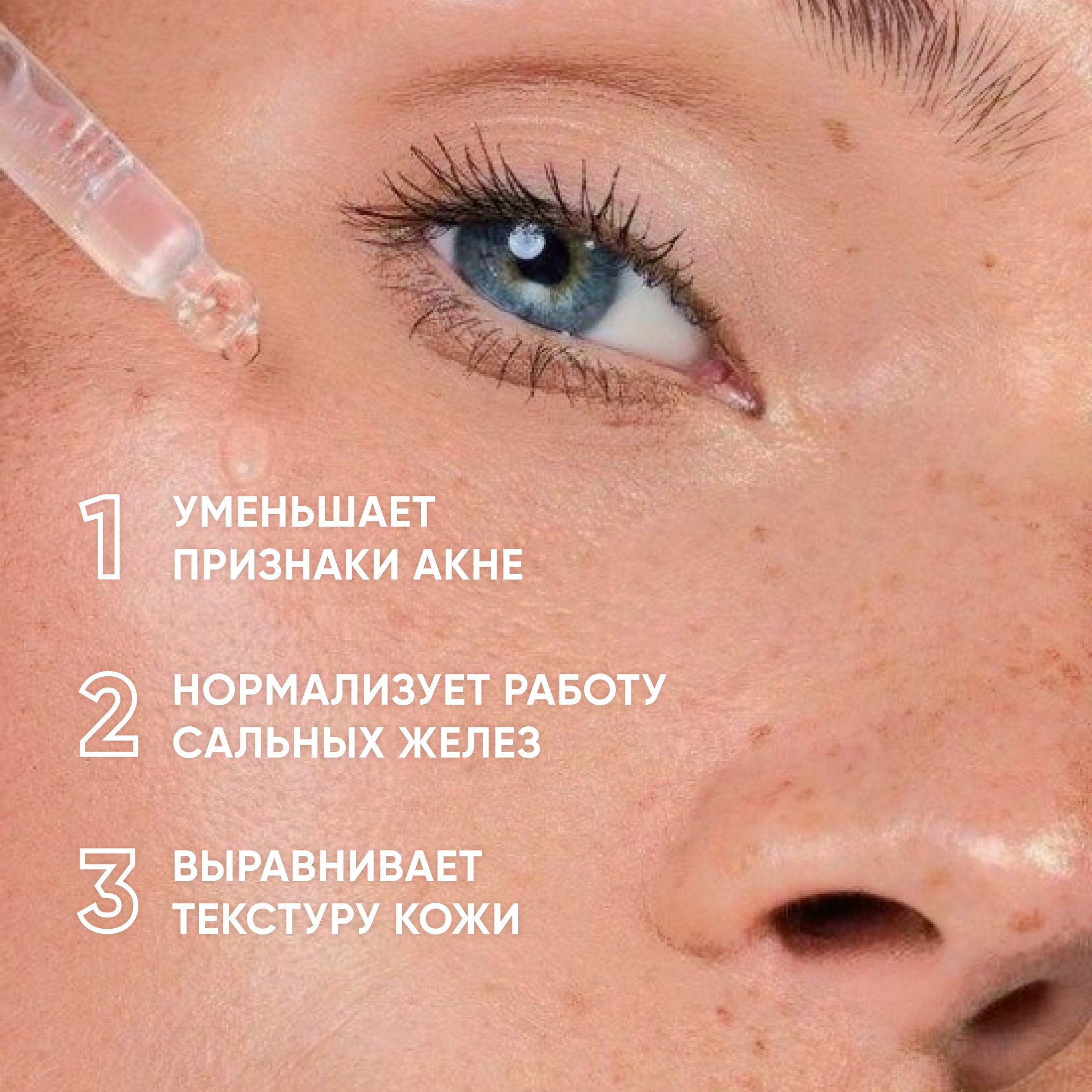 Пилинг для проблемной кожи 11% Anti-acne Smart Peel System  купить в VISAGEHALL