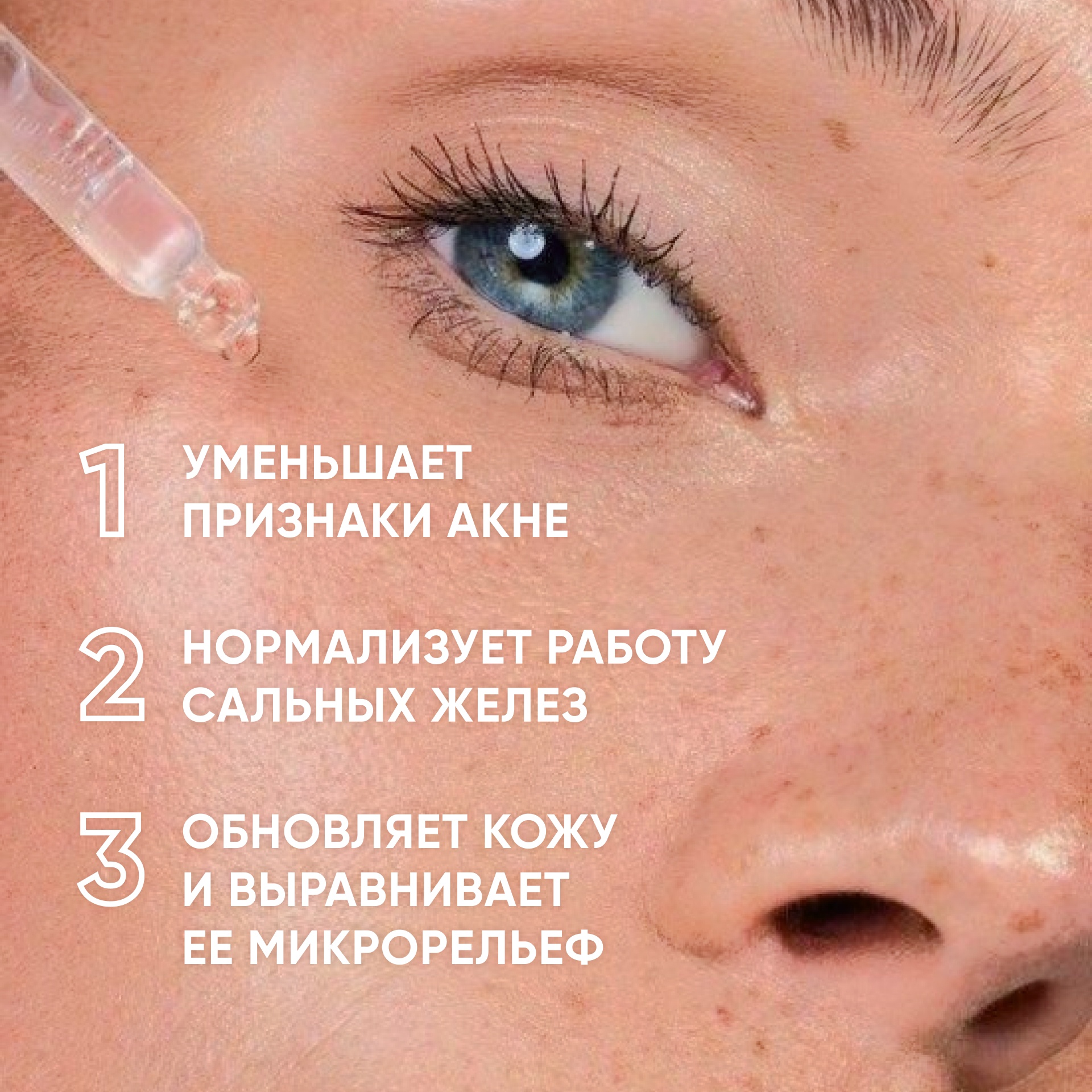 Пилинг-система для проблемной кожи 18% Anti-acne Smart Peel System  купить в VISAGEHALL