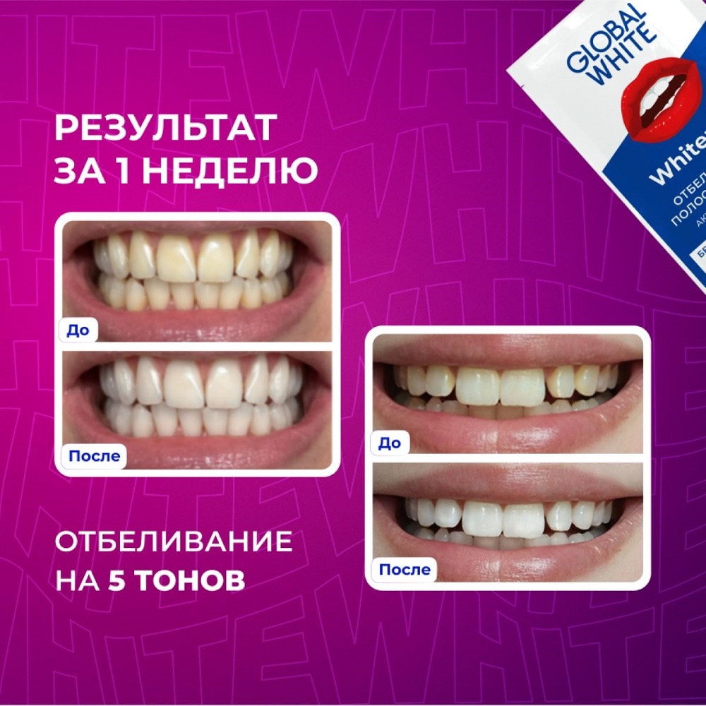 Полоски для зубов отбеливающие Малина 2 саше купить в VISAGEHALL