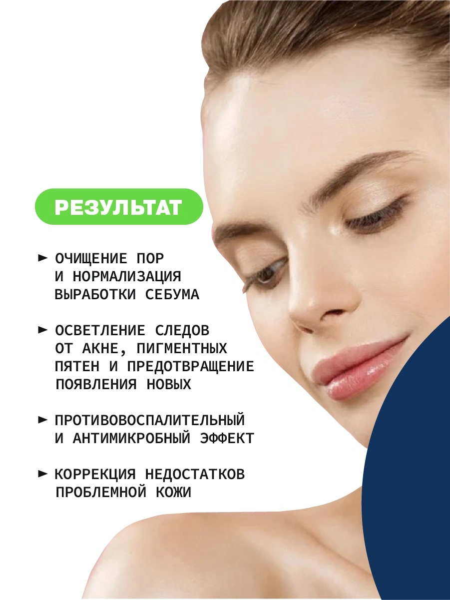 Анти-акне крем противовоспалительный для лица Azelaic acid 15% купить в VISAGEHALL