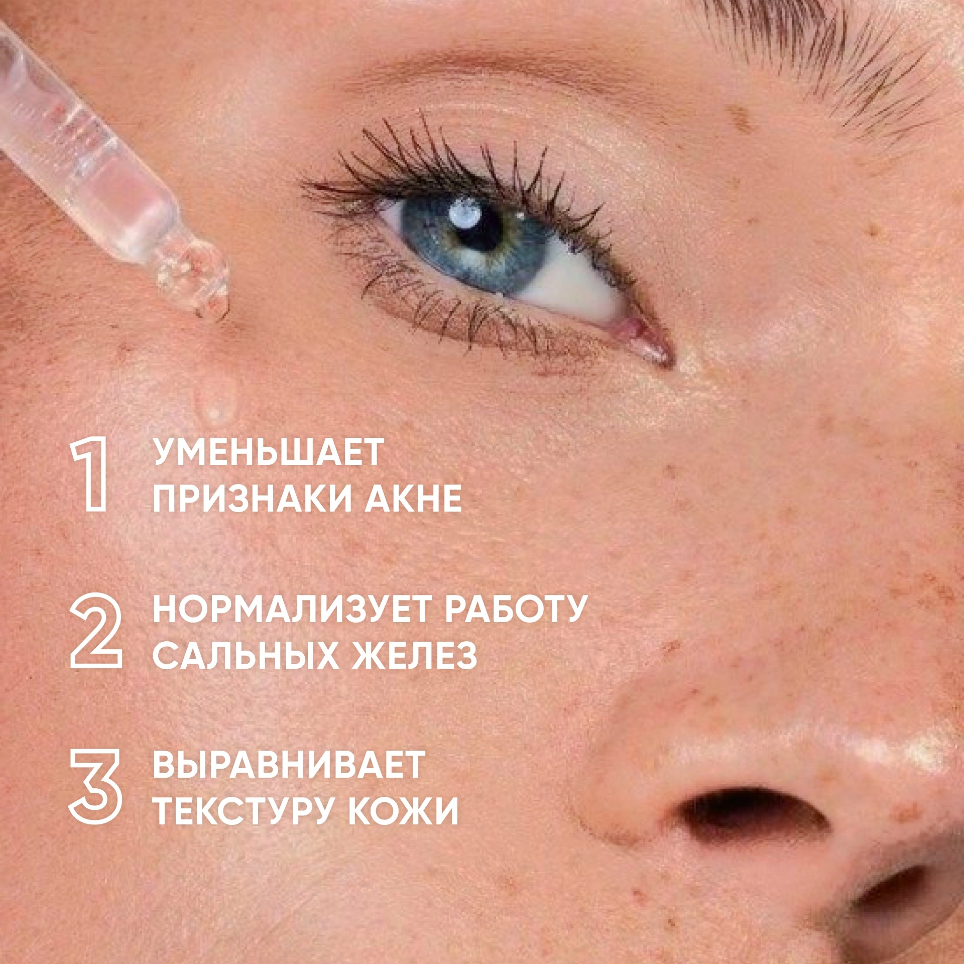 Icon Skin Пилинг для проблемной кожи 11% Anti-acne Smart Peel System –  купить в VISAGEHALL