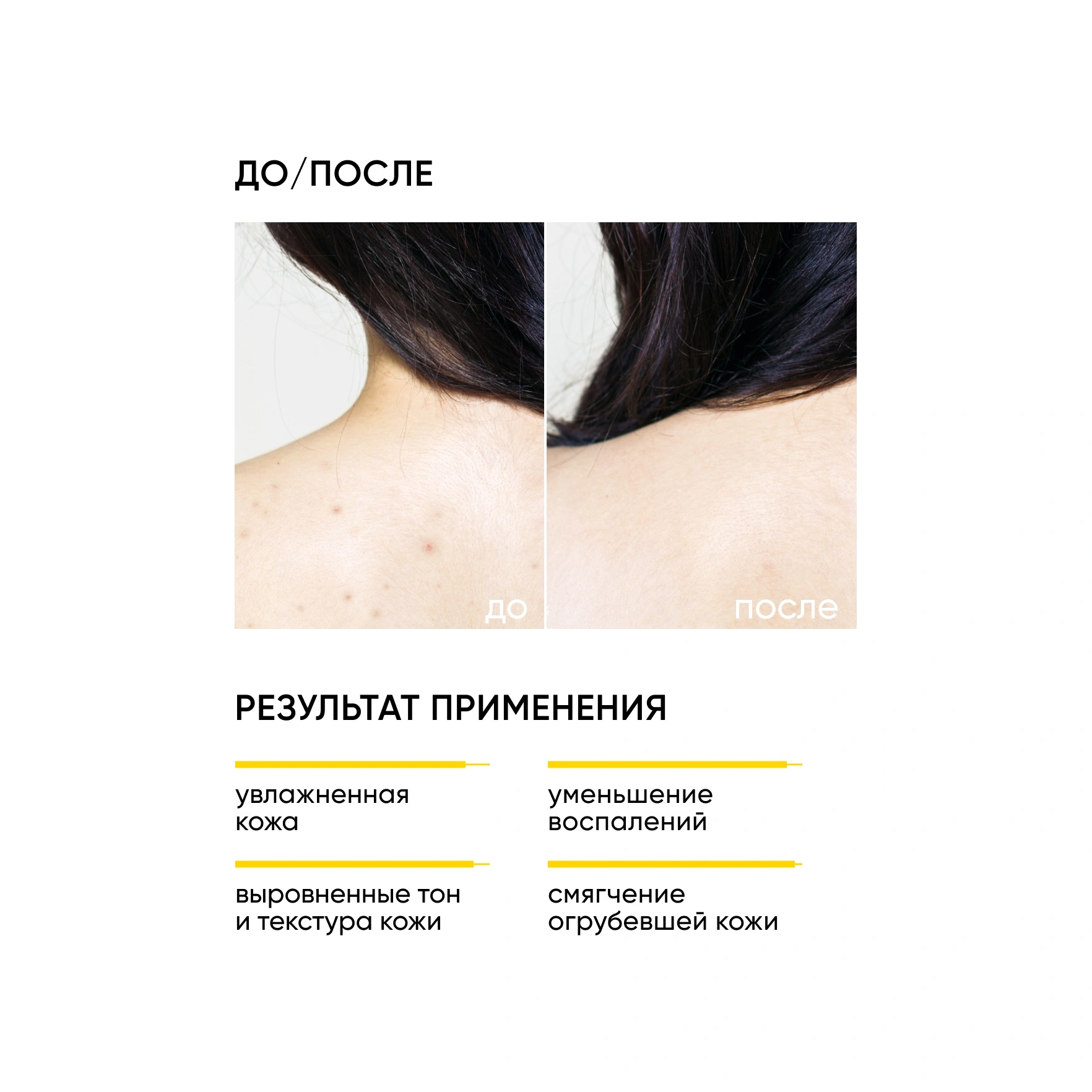 Крем для тела обновляющий с кислотами Skin Renewal купить в VISAGEHALL